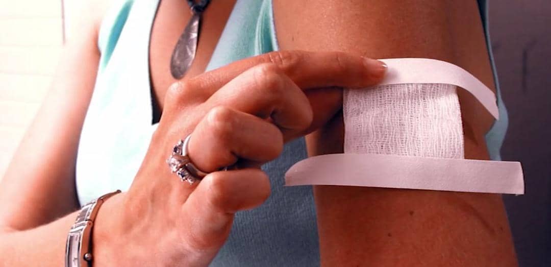 Plaster Canggih Buatan NASA Ini Bisa Sembuhkan Luka dalam Sehari!