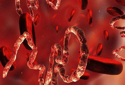Ilustrasi virus ebola