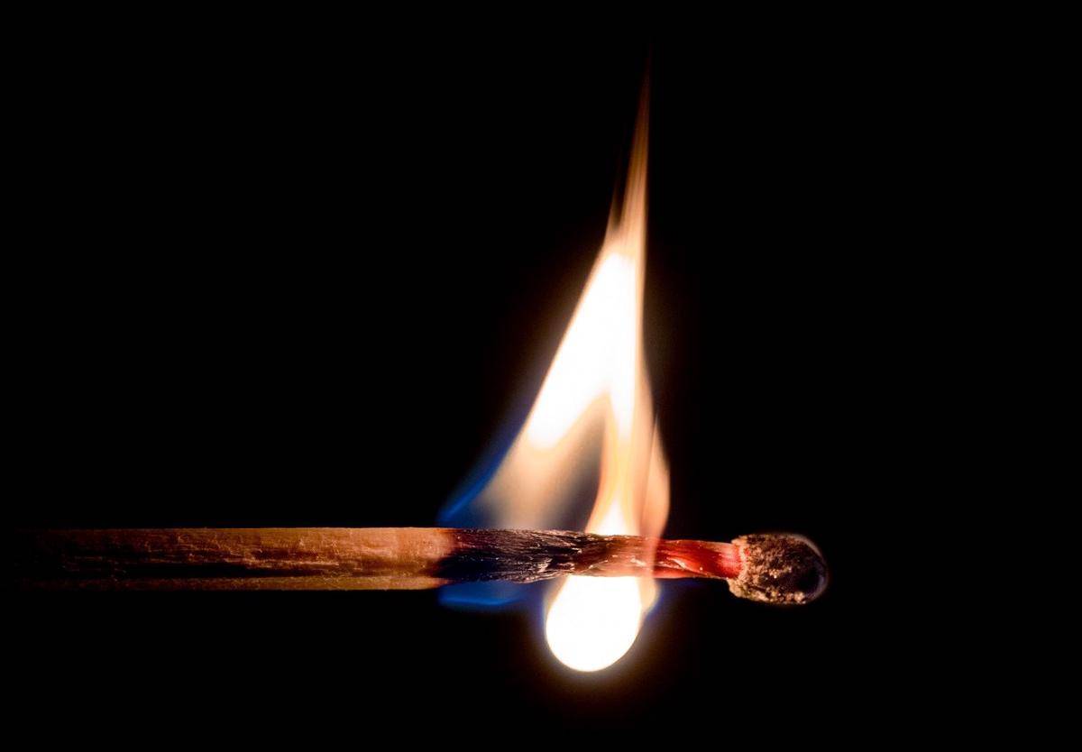 luka bakar