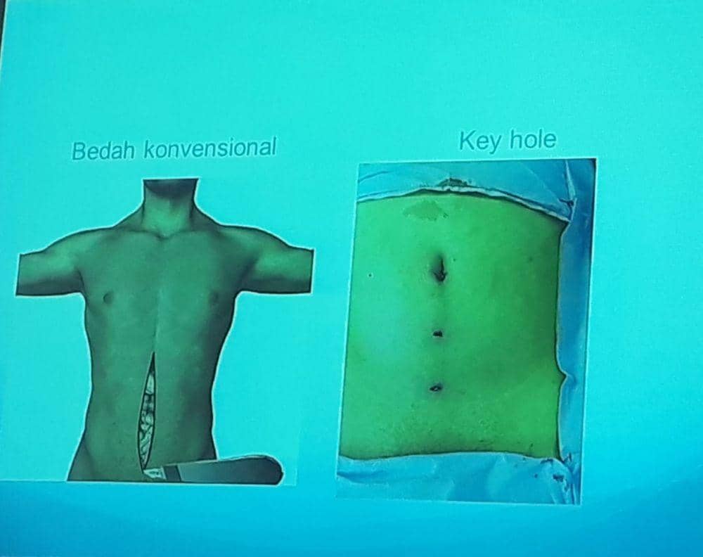 IDN Times/Indiana Malia