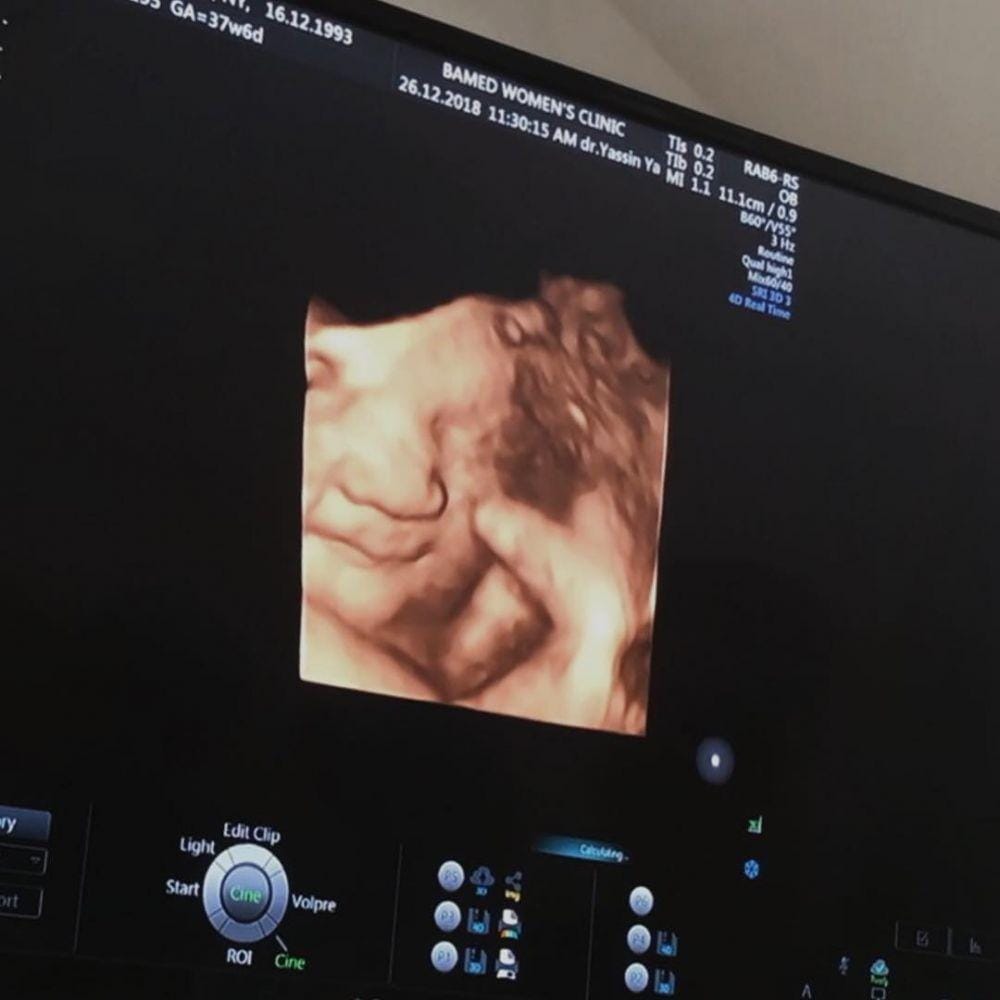 instagram.com/dwihandaanda