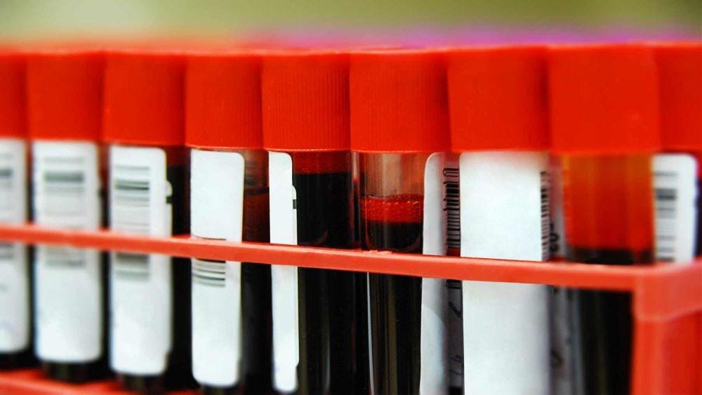 wexnermedical.osu.edu