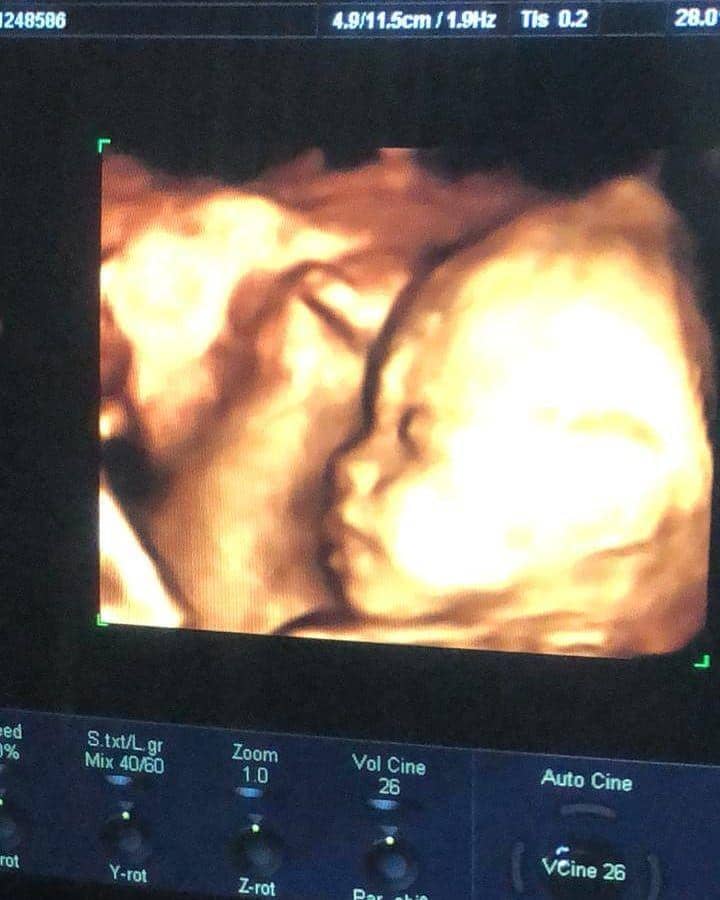 instagram.com/dj_kattybutterfly36