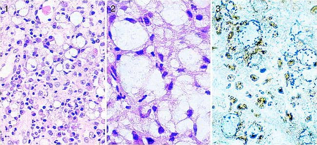 pathologyoutlines.com