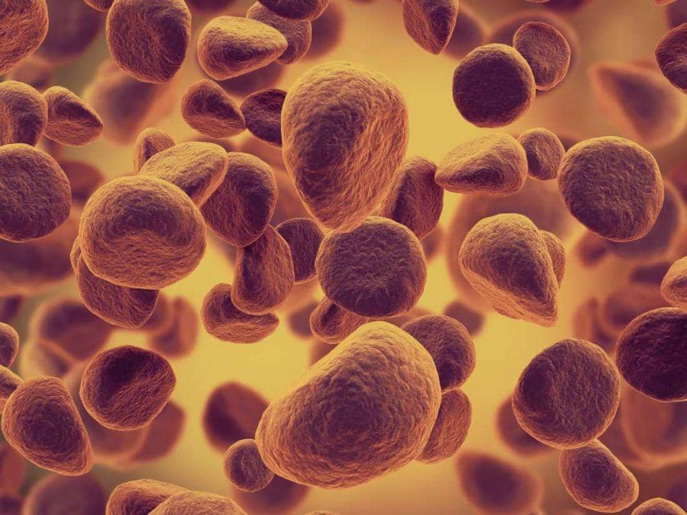 medicalnewstoday.com