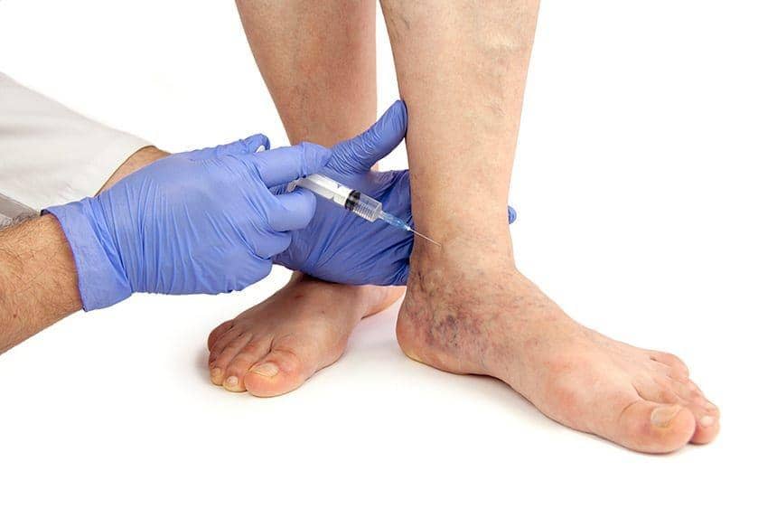 columbusveincenter.com