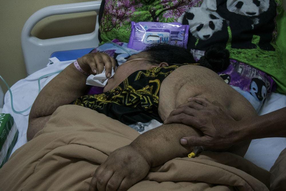 ANTARA FOTO/Novrian Arbi