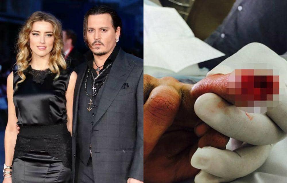 Gugat Balik Mantan Istri, 6 Fakta Kasus KDRT Johnny Depp & Amber Heard