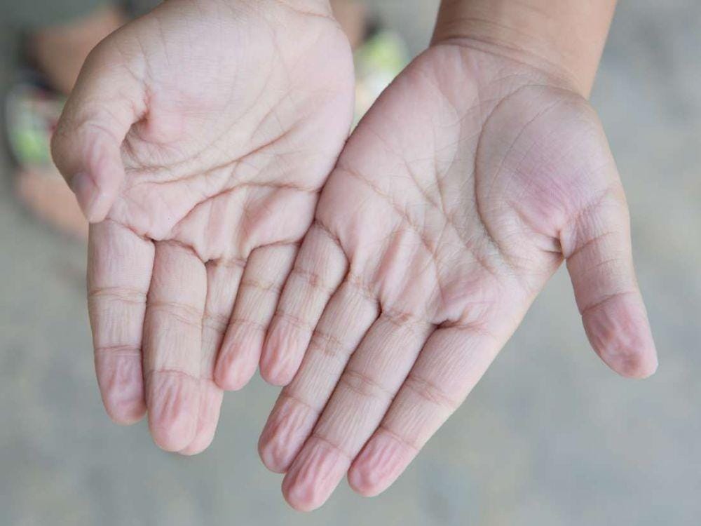 medicalnewstoday.com