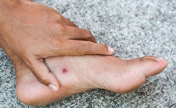 woundcarecenters.org