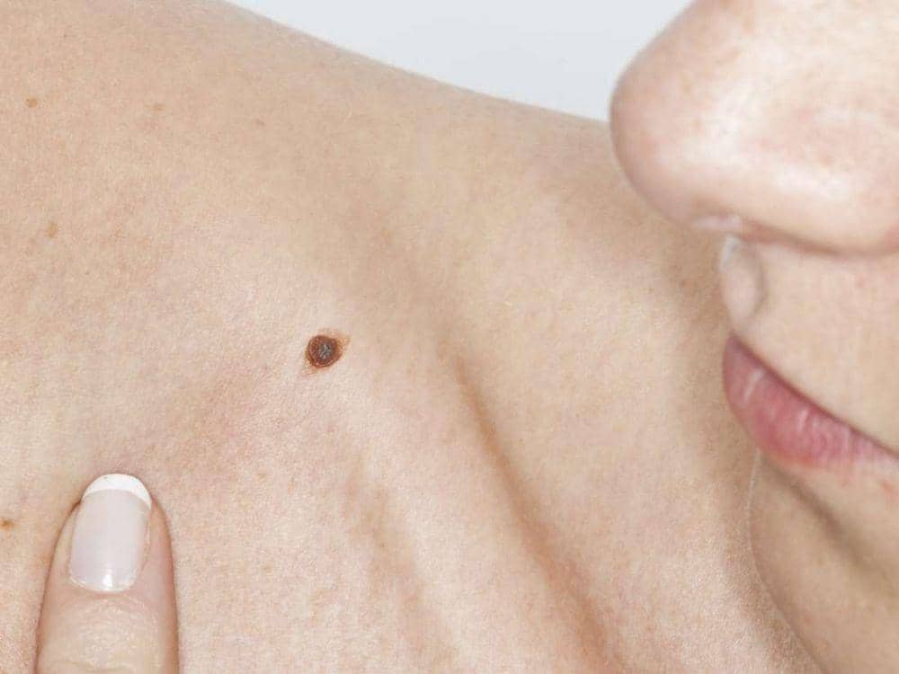 medicalnewstoday.com