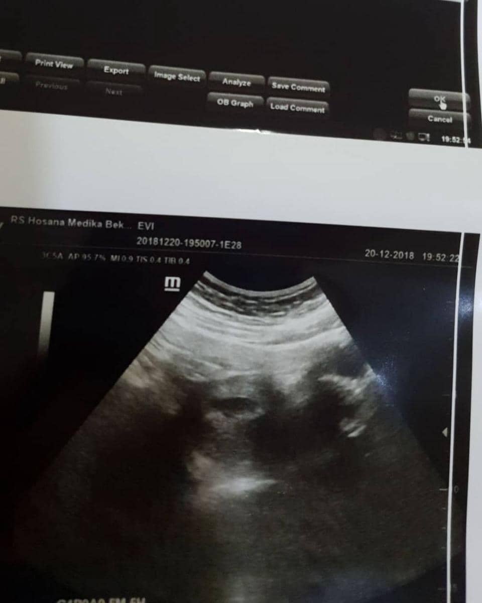 Instagram.com/evi_masamba_real