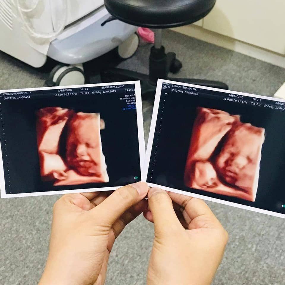 Instagram.com/tommykurniawan