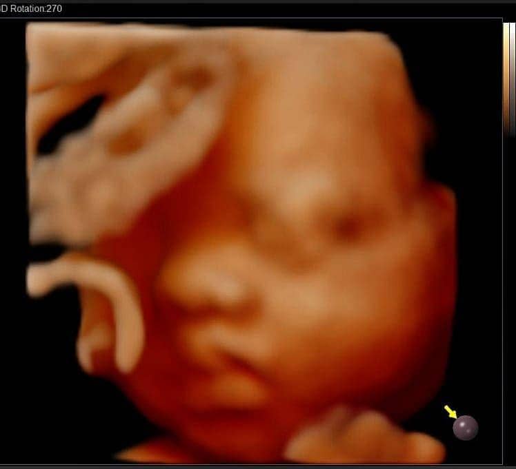 Instagram.com/dj_kattybutterfly36