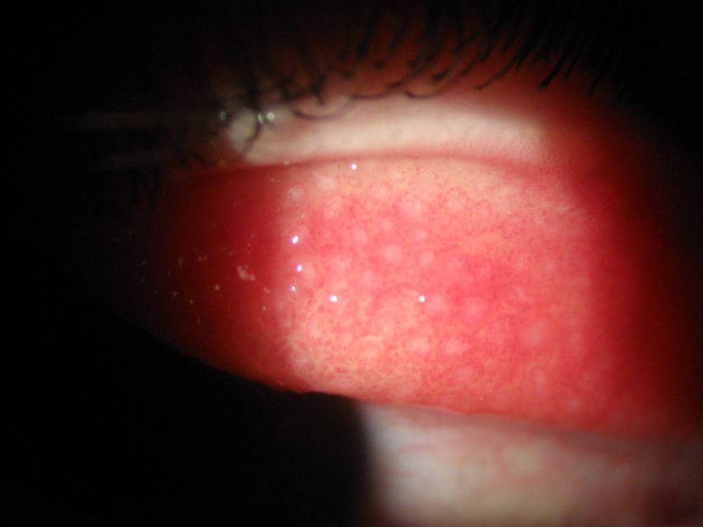 precisionfamilyeyecare.com