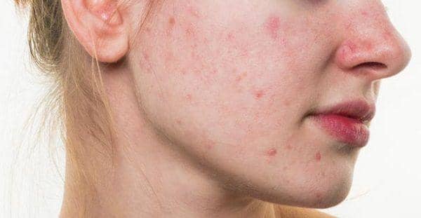 consumerhealthdigest.com