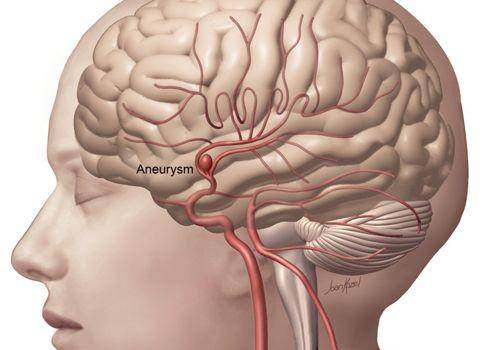neurosurgery.wustl.edu