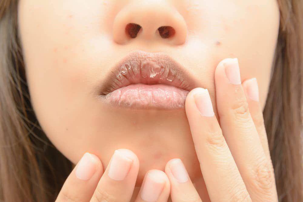 hellosehat.com