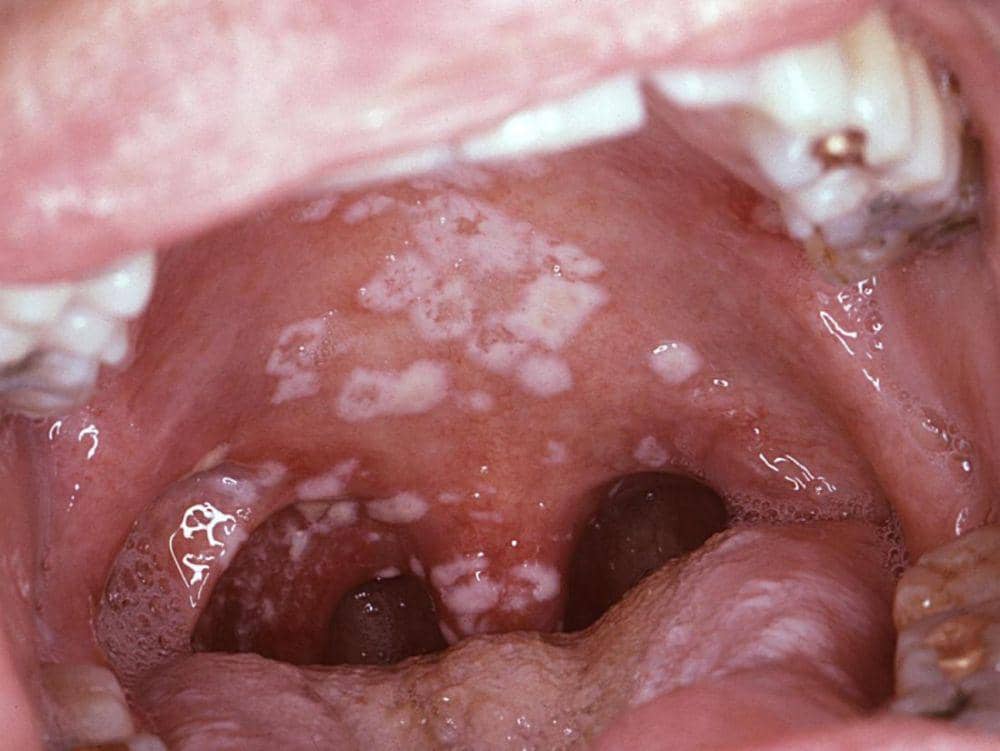 medicalnewstoday.com