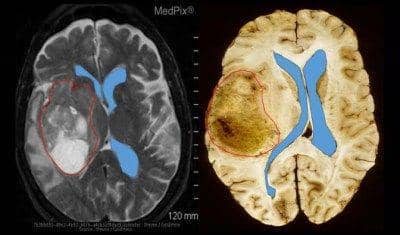 nlmdirector.nlm.nih.gov