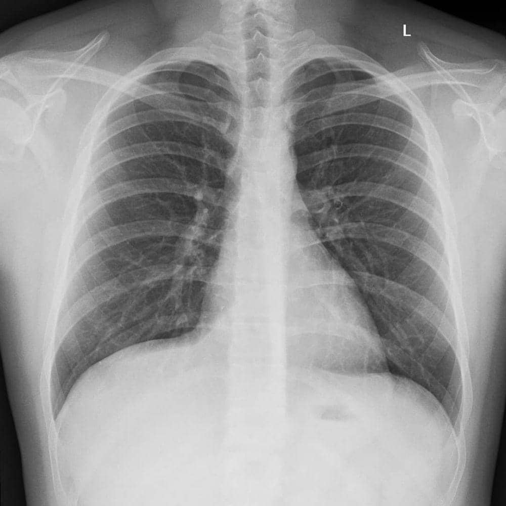 instagram.com/pomeraniai_torpejean