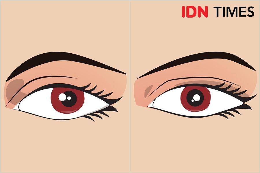 IDN Times/Arief Rahmat