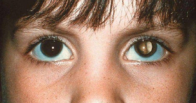 6 Fakta Sepele yang Mungkin Menyelamatkan Hidupmu Suatu Hari Nanti