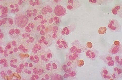 webpath.med.utah.edu