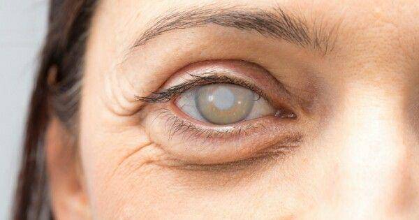 allaboutvision.com