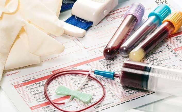6 Tes Darah untuk Mengetahui Kondisi Tubuh yang Wajib Kamu Ketahui