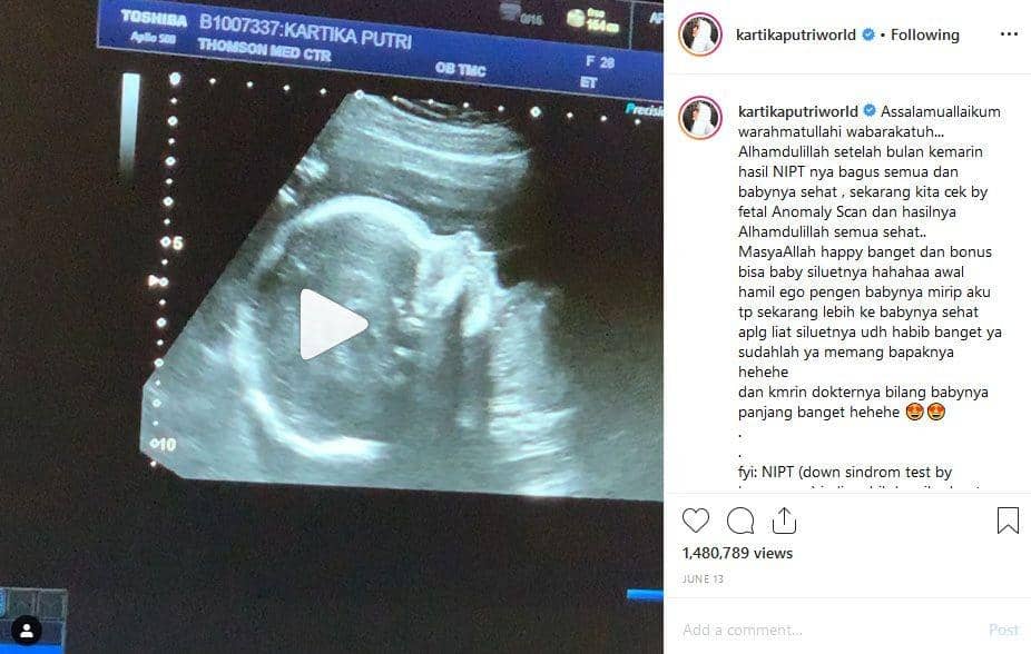 Instagram.com/kartikaputriworld