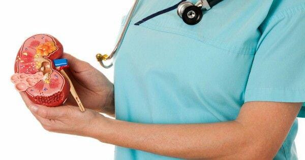 Dokter menunjukan sakit batu ginjal