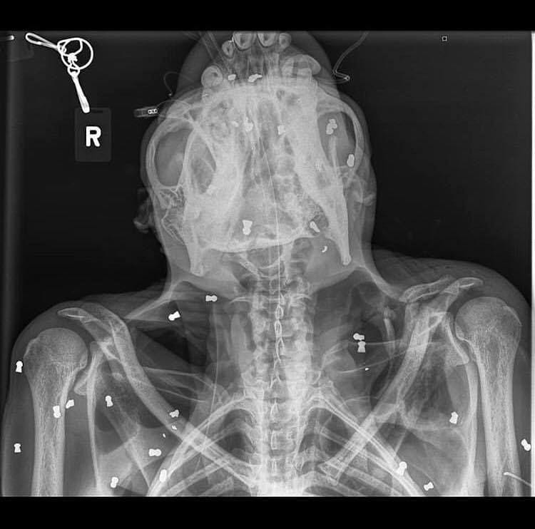 (Hasil x ray orang utan Hope yang menunjukkan terdapat peluru) www.facebook.com/kitabisa.com
