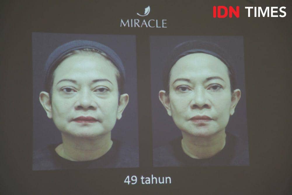 IDN Times/Rully Bunga