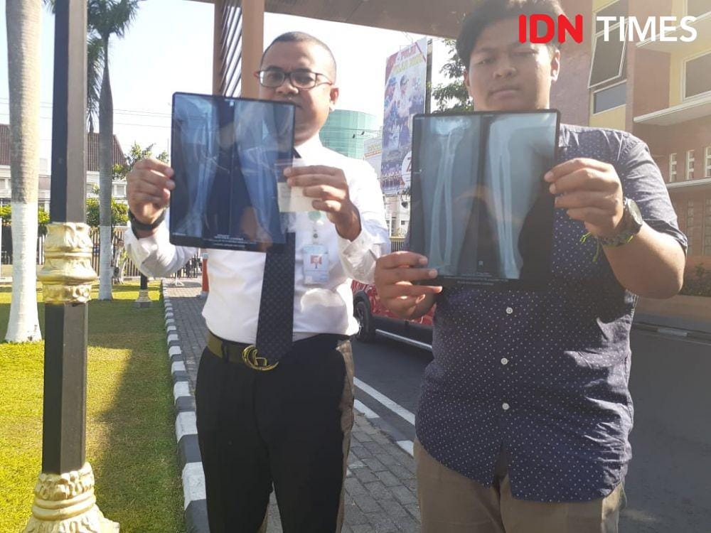 IDN Times/Tunggul Kumoro