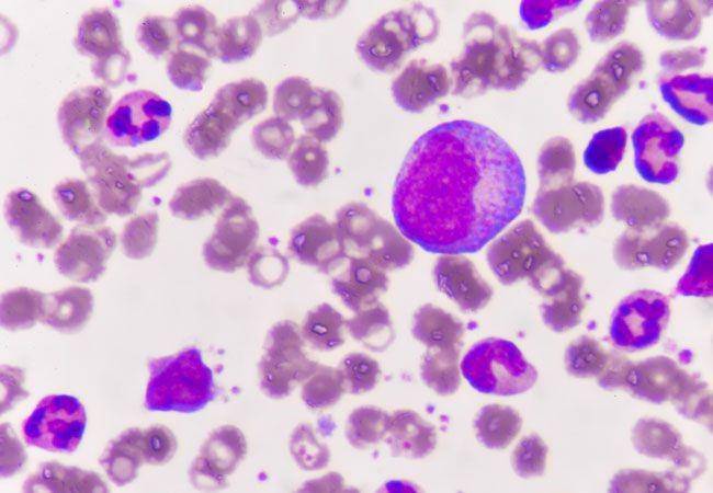clevelandclinic.org