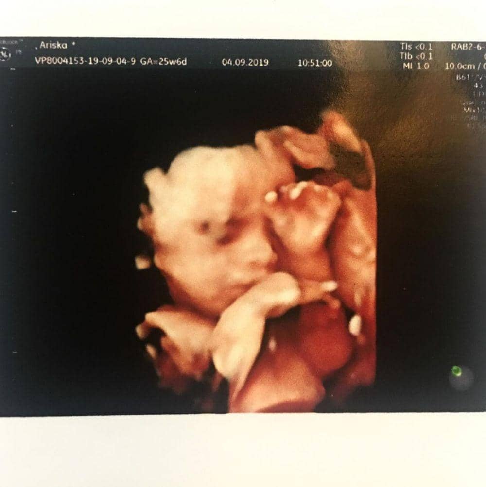 Instagram.com/ariskaputripertiwii