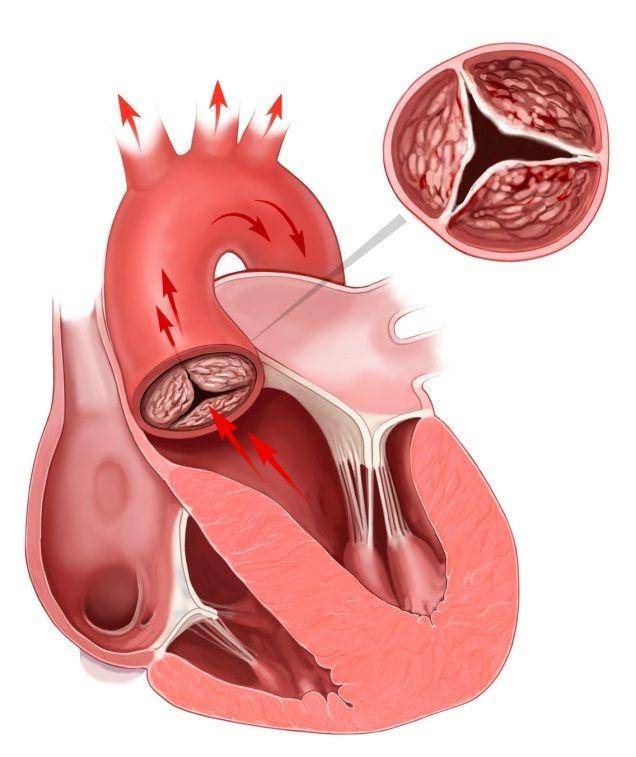 columbiaheartvalve.org