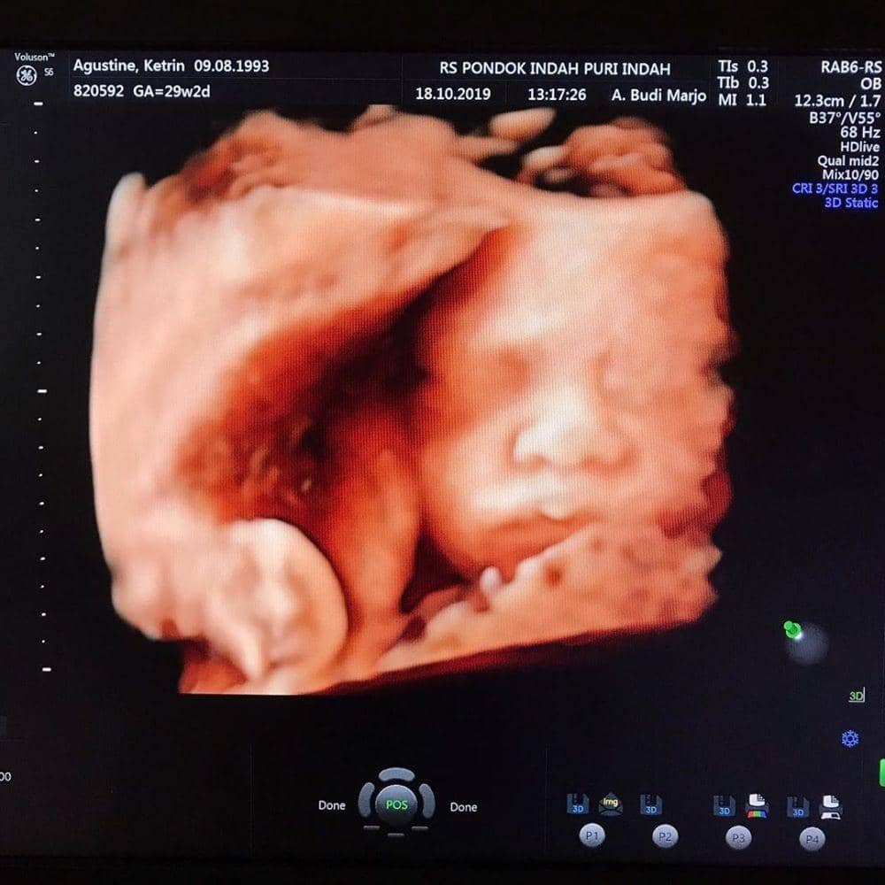 Instagram.com/kethagustine