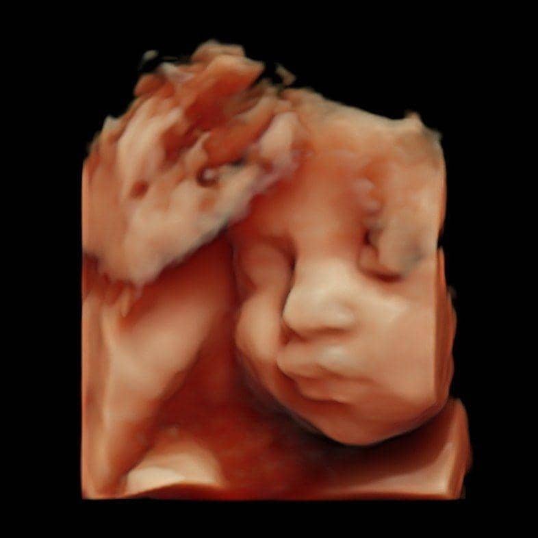 Instagram.com/rachelvennya