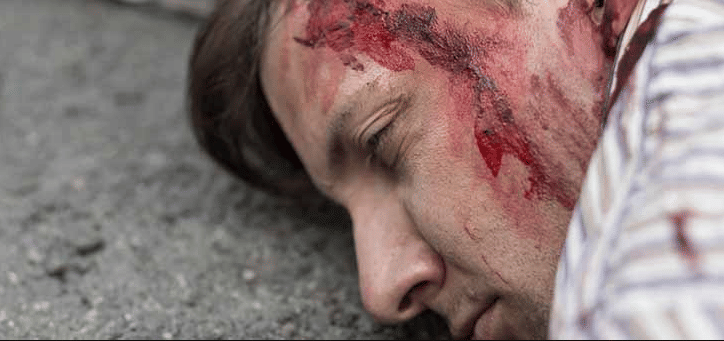 Foto ilustrasi pura-pura kepala terluka. discover.dc.nihr.ac.uk