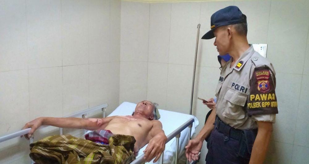 Moch Chozien Maksun (77), tekapar di RSUD Kanujoso Djatiwibowo akibat terkena air panas. Sumber: Istimewa