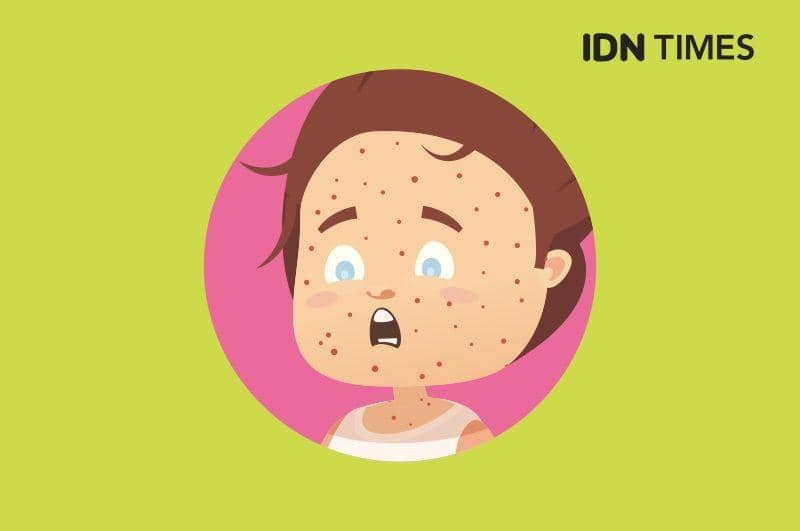 IDN Times/Mardya Shakti