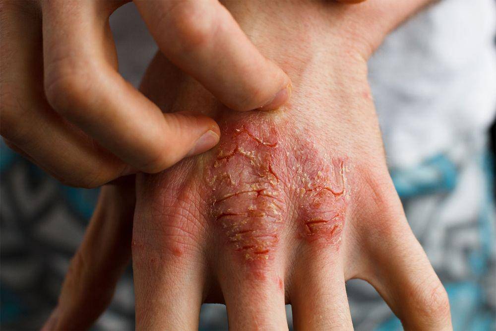 skinandrash.com