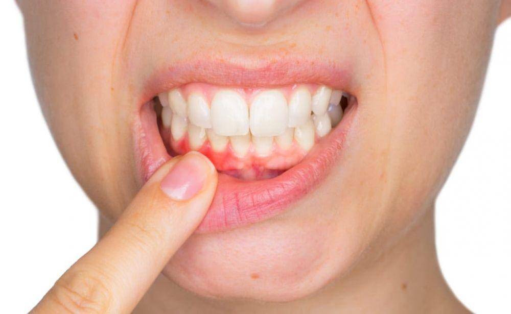 smartmouth.com