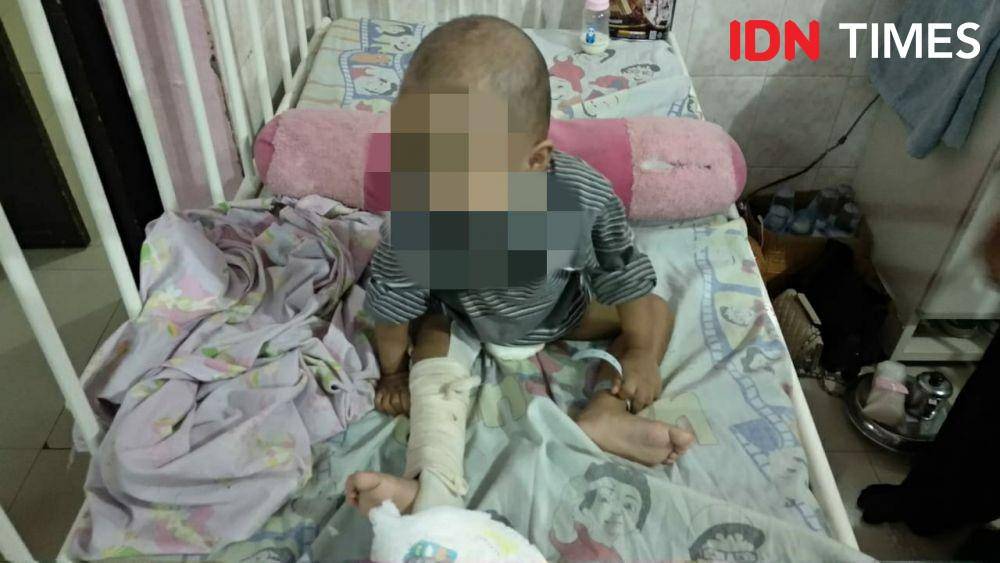 Budi--bukan nama sebenarnya--balita yang disiksa ibu kandungnya hingga kakinya patah (IDN Times/Yuda Almerio)