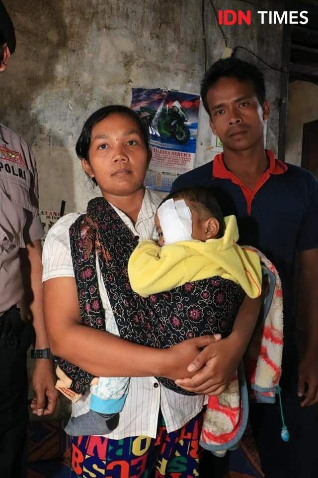 Bupati Simalungun JR Saragih menjenguk anak Husor Gultom yang menderita penyakit mata langka (IDN Times/Patiar Manurung)