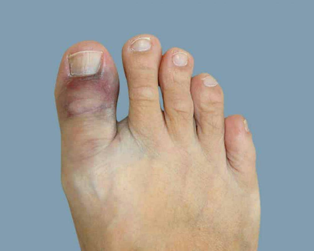 heelhurt.com