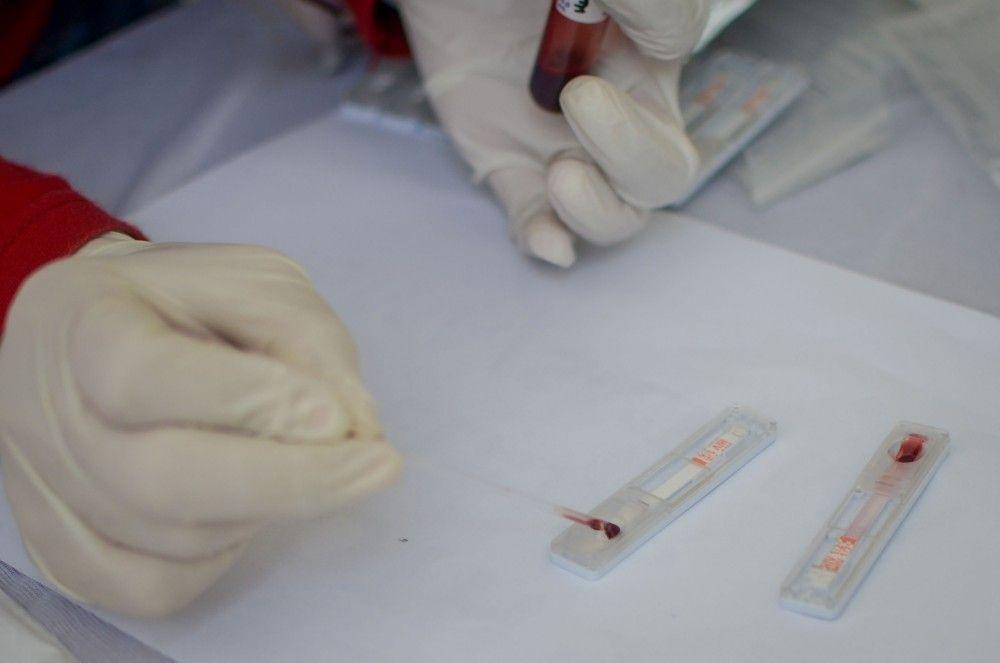 Petugas melakukan tes HIV pada darah seorang warga saat pemeriksaan HIV secara gratis di halaman Gedung Sate, Bandung, Jawa Barat, Sabtu (30/11/2019). (ANTARA FOTO/Raisan Al Farisi)
