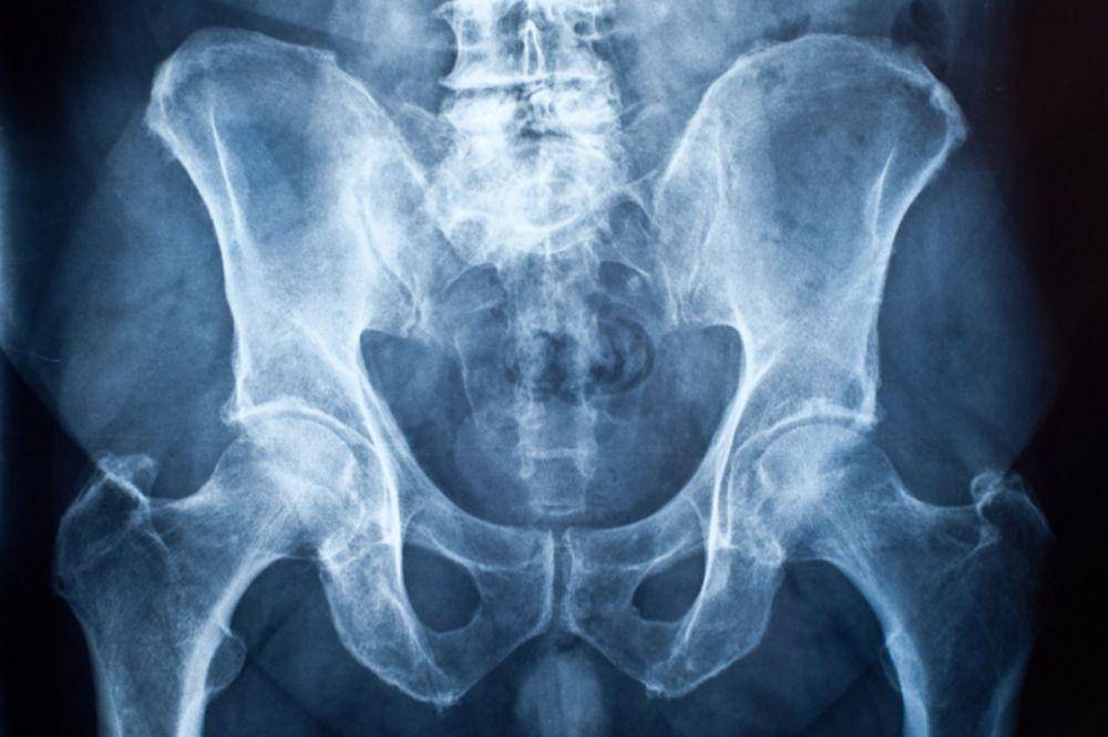 health.usnews.com